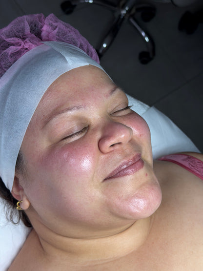 Procell Theraphies treatment