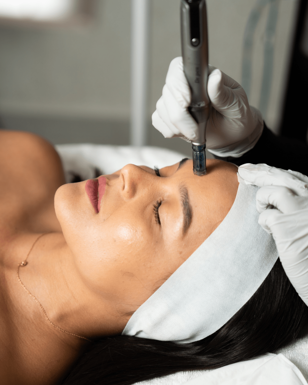 Microagujas facial💫 - Esthetic Nails Boutique